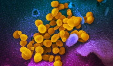 This scanning electron microscope image shows SARS-CoV-2 (yellow) isolated from a patient in the U.S., emerging from the surface of cells (blue/pink) cultured in the lab. Image credit: NIAID.