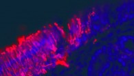 A tissue section from a human nasal biopsy. The red staining outlines olfactory neurons and the blue staining is counterstain for cell nuclei. Image credit: Brad Goldstein.