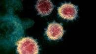 This transmission electron microscope image shows SARS-CoV-2, also known as 2019-nCoV, isolated from a patient in the U.S. Virus particles are shown emerging from the surface of cells cultured in the lab. The spikes on the outer edge of the virus particles give coronaviruses their name, crown-like. Image credit: NIAID.