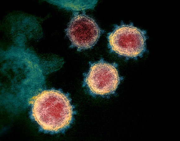 This transmission electron microscope image shows SARS-CoV-2, also known as 2019-nCoV, isolated from a patient in the U.S. Virus particles are shown emerging from the surface of cells cultured in the lab. The spikes on the outer edge of the virus particles give coronaviruses their name, crown-like. Image credit: NIAID.
