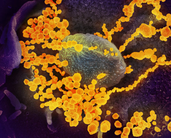 This scanning electron microscope image shows SARS-CoV-2 (round gold objects) emerging from the surface of cells cultured in the lab. The virus shown was isolated from a patient in the U.S. Image credit: NIAID-RML.