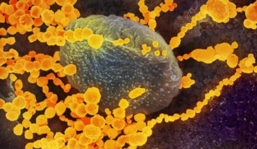 This scanning electron microscope image shows SARS-CoV-2 (round gold objects) emerging from the surface of cells cultured in the lab. The virus shown was isolated from a patient in the U.S. Image credit: NIAID-RML.