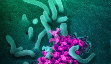 This scanning electron microscope image shows SARS-CoV-2 (round magenta objects) emerging from the surface of cells cultured in the lab. The virus shown was isolated from a patient in the U.S. Image credit: NIAID-RML.