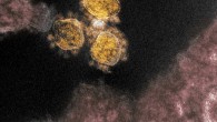 This transmission electron microscope image shows SARS-CoV-2 virus isolated from a patient in the U.S. Virus particles (round gold objects) are shown emerging from the surface of cells cultured in the lab. The spikes on the outer edge of the virus particles give coronaviruses their name, crown-like. Image credit: NIAID-RML.