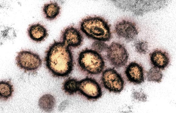 This transmission electron microscope image shows SARS-CoV-2 isolated from a patient in the U.S. Image credit: NIAID-RML.