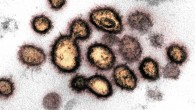 This transmission electron microscope image shows SARS-CoV-2 isolated from a patient in the U.S. Image credit: NIAID-RML.