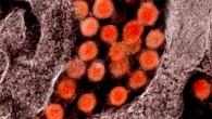 Transmission electron micrograph of SARS-CoV-2 virus particles, isolated from a patient. Image credit: NIAID.