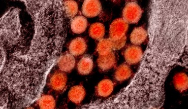 Transmission electron micrograph of SARS-CoV-2 virus particles, isolated from a patient. Image credit: NIAID.