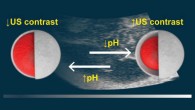 Walker et al developed a solid-state ultrasound contrast agent for monitoring pH fluctuations. Image credit: Walker et al, doi: 10.1021/acssensors.0c00245.