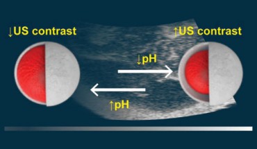 Walker et al developed a solid-state ultrasound contrast agent for monitoring pH fluctuations. Image credit: Walker et al, doi: 10.1021/acssensors.0c00245.
