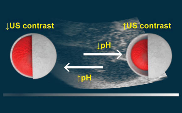 Walker et al developed a solid-state ultrasound contrast agent for monitoring pH fluctuations. Image credit: Walker et al, doi: 10.1021/acssensors.0c00245.