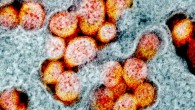 Transmission electron micrograph of SARS-CoV-2 virus particles, isolated from a patient. Image credit: NIAID.