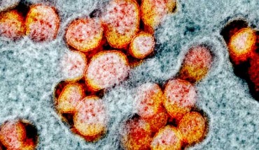 Transmission electron micrograph of SARS-CoV-2 virus particles, isolated from a patient. Image credit: NIAID.