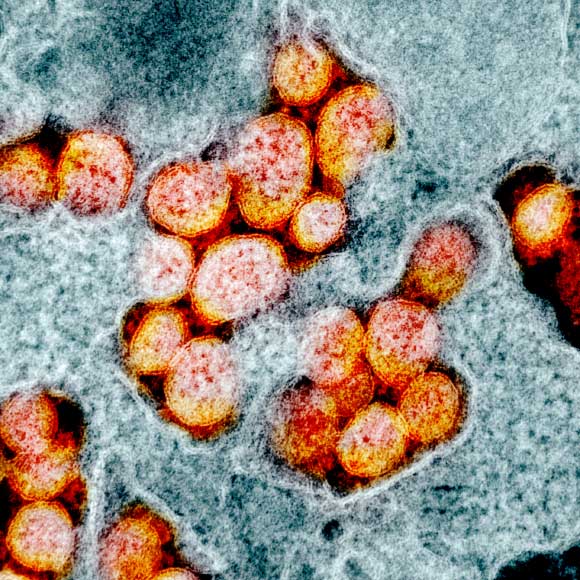 Transmission electron micrograph of SARS-CoV-2 virus particles, isolated from a patient. Image credit: NIAID.