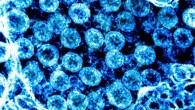 Transmission electron micrograph of SARS-CoV-2 virus particles, isolated from a patient. Image credit: NIAID.