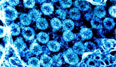 Transmission electron micrograph of SARS-CoV-2 virus particles, isolated from a patient. Image credit: NIAID.