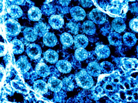 Transmission electron micrograph of SARS-CoV-2 virus particles, isolated from a patient. Image credit: NIAID.