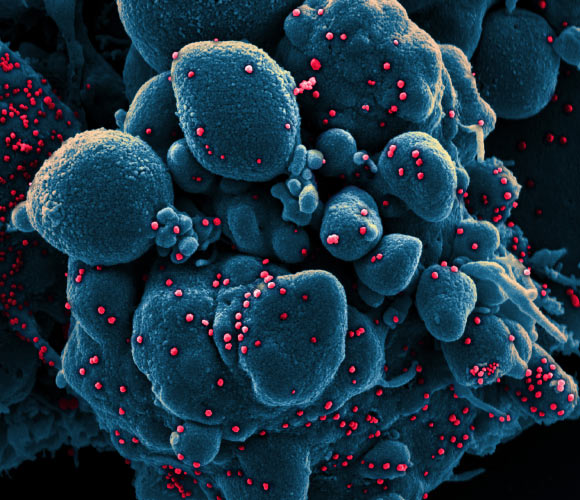 Colorized scanning electron micrograph of an apoptotic cell (blue) infected with SARS-COV-2 virus particles (red), isolated from a patient sample. Image credit: NIAID.