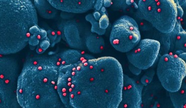 Colorized scanning electron micrograph of an apoptotic cell (blue) infected with SARS-COV-2 virus particles (red), isolated from a patient sample. Image credit: NIAID.