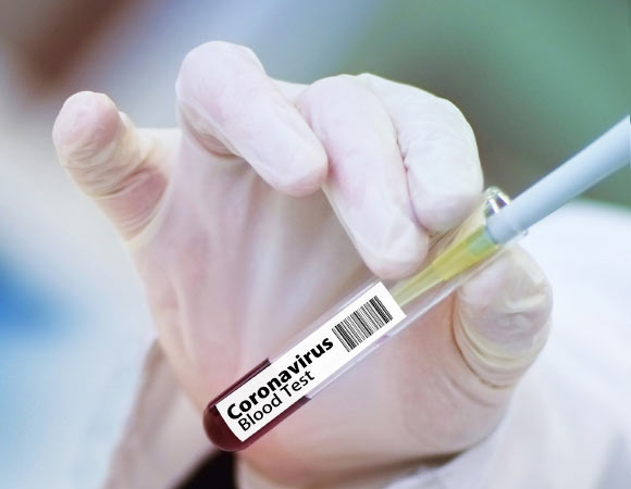 A vaccine must go through six crucial steps. Image credit: Gerd Altmann.