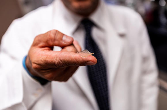The PittCoVacc vaccine is delivered into the skin through a fingertip-sized patch of microscopic needles. Image credit: University of Pittsburgh School of Medicine.