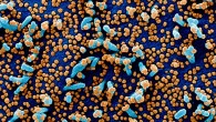 Colorized scanning electron micrograph of a VERO E6 cell (blue) heavily infected with SARS-COV-2 virus particles (orange), isolated from a patient sample. Image credit: NIAID.