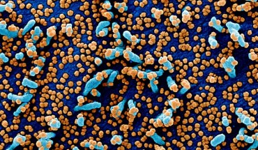 Colorized scanning electron micrograph of a VERO E6 cell (blue) heavily infected with SARS-COV-2 virus particles (orange), isolated from a patient sample. Image credit: NIAID.