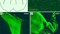 Intracortical grafts of human long-term self-renewing neuroepithelial-like stem (lt-NES) cell-derived cortical neurons project extensively in stroke-injured rat brain: (A) location of illustrated areas; (B-D) fibers immunoreactive for human cytoplasmic marker STEM121 in the transplant core (B), corpus callosum (C), and peri-infarct area (D). Scale bar - 200 μm. Image credit: Palma-Tortosa et al, doi: 10.1073/pnas.2000690117.