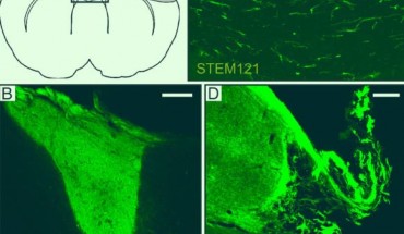 Intracortical grafts of human long-term self-renewing neuroepithelial-like stem (lt-NES) cell-derived cortical neurons project extensively in stroke-injured rat brain: (A) location of illustrated areas; (B-D) fibers immunoreactive for human cytoplasmic marker STEM121 in the transplant core (B), corpus callosum (C), and peri-infarct area (D). Scale bar - 200 μm. Image credit: Palma-Tortosa et al, doi: 10.1073/pnas.2000690117.