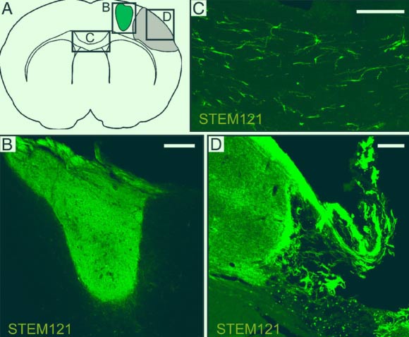 Intracortical grafts of human long-term self-renewing neuroepithelial-like stem (lt-NES) cell-derived cortical neurons project extensively in stroke-injured rat brain: (A) location of illustrated areas; (B-D) fibers immunoreactive for human cytoplasmic marker STEM121 in the transplant core (B), corpus callosum (C), and peri-infarct area (D). Scale bar - 200 μm. Image credit: Palma-Tortosa et al, doi: 10.1073/pnas.2000690117.