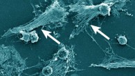 Neutrophils forming NETs in cell culture. Note the expelled DNA strings (arrows). Scanning electron microscopy of neutrophils 3 h after plating and coculturing with 4T1 breast cancer cells. Scale bar - 25 µm. Image credit: Barnes et al, doi: 10.1084/jem.20200652.