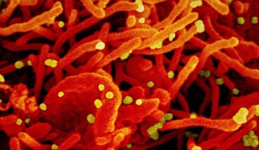Colorized scanning electron micrograph of an apoptotic cell (red) infected with SARS-COV-2 virus particles (yellow), isolated from a patient sample. Image credit: NIAID.