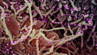 Colorized scanning electron micrograph of a VERO E6 cell (purple) exhibiting elongated cell projections and signs of apoptosis, after infection with SARS-CoV-2 virus particles (pink), which were isolated from a patient sample. Image credit: NIAID.