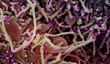 Colorized scanning electron micrograph of a VERO E6 cell (purple) exhibiting elongated cell projections and signs of apoptosis, after infection with SARS-CoV-2 virus particles (pink), which were isolated from a patient sample. Image credit: NIAID.