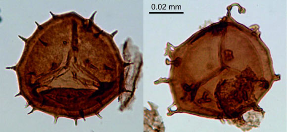 Normal (left) and malformed (right) spores from East Greenland. Image credit: John Marshall.