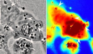 Left: squid reflectin protein nanostructures in human cells (dark regions, with some indicated by white arrows). Right: associated pathlength for light traveling through a given area (red corresponds to longer pathlengths and blue corresponds to shorter pathlengths). Image credit: Atouli Chatterjee / University of California, Irvine.