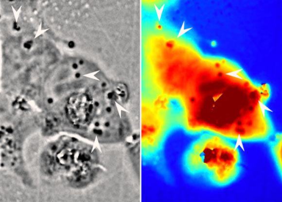 Left: squid reflectin protein nanostructures in human cells (dark regions, with some indicated by white arrows). Right: associated pathlength for light traveling through a given area (red corresponds to longer pathlengths and blue corresponds to shorter pathlengths). Image credit: Atouli Chatterjee / University of California, Irvine.