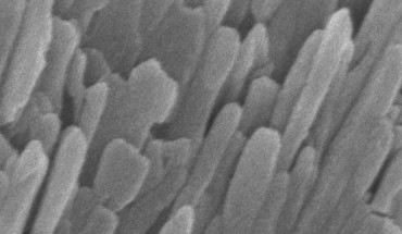 Enamel is made up of tightly bunched, oblong crystals that are about 1,000 times smaller in width than a human hair. Image credit: Karen DeRocher, Northwestern University.