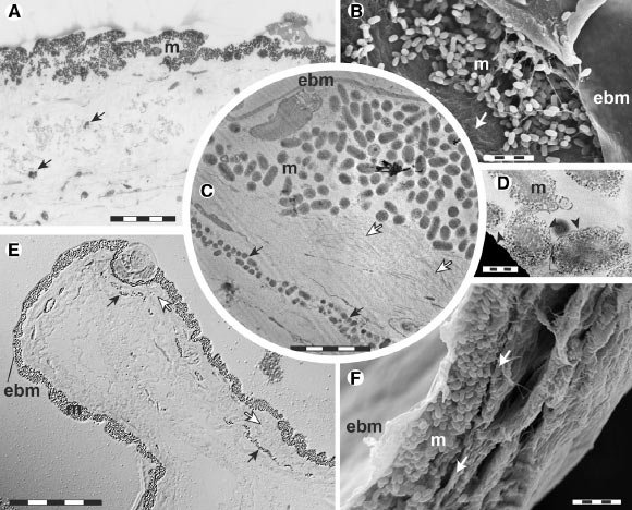 Histology and TEM of the skin of Oneirodes sp. (A) and Idiacanthus antrostomas (B-F) reveal a continuous layer of melanosomes (m) immediately beneath the epidermal basement membrane (ebm). Melanosomes are membrane-bound organelles (black arrowheads). Melanophores (black arrows) are seen beneath the stratum compactum (white arrows). Scale bars - 50 mm in (A and E), 5 mm in (B, C, and F), 0.5 mm in (D). Image credit: Davis et al, doi: 10.1016/j.cub.2020.06.044.