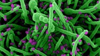 Colorized scanning electron micrograph of a cell (green) infected with SARS-CoV-2 virus particles (purple), isolated from a patient sample. Image credit: NIAID.