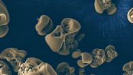 This SEM image shows manganese oxide nodules generated by Candidatus Manganitrophus noduliformans. The nodules are generally about 0.1 to 0.5 mm in diameter. Image credit: Hang Yu / Caltech.
