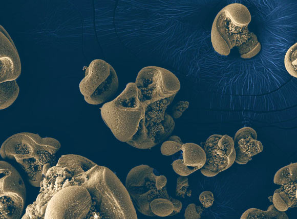 This SEM image shows manganese oxide nodules generated by Candidatus Manganitrophus noduliformans. The nodules are generally about 0.1 to 0.5 mm in diameter. Image credit: Hang Yu / Caltech.