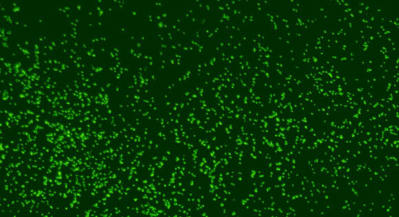 Magnified image showing microbes revived from 101.5 million-year-old (Cretaceous period) sediment. Image credit: Japan Agency for Marine-Earth Science and Technology.