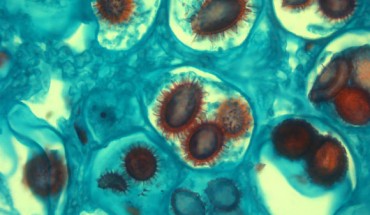 Spores of Tuber luomae. Image credit: Joyce Eberhart.