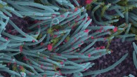 This SEM image shows SARS-CoV-2 virions (red) produced by human airway epithelia. Image credit: Camille Ehre, doi: 10.1056/NEJMicm2023328.