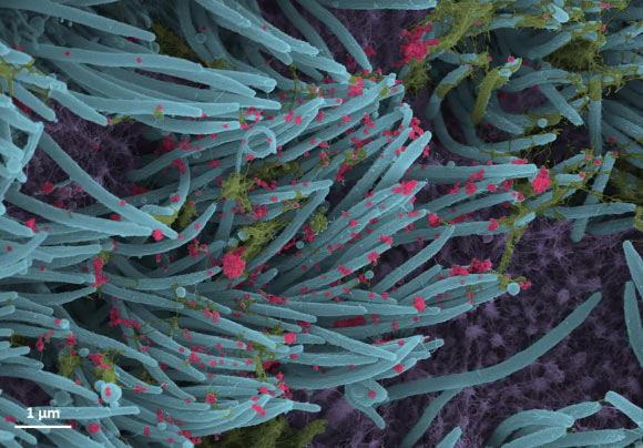 This SEM image shows SARS-CoV-2 virions (red) produced by human airway epithelia. Image credit: Camille Ehre, doi: 10.1056/NEJMicm2023328.