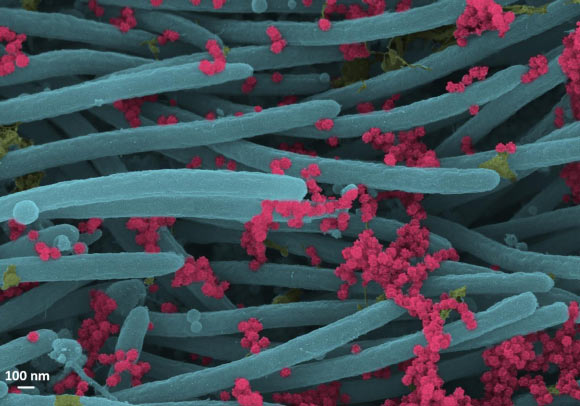 A higher power magnification image shows the structure and density of SARS-CoV-2 virions (red). Image credit: Camille Ehre, doi: 10.1056/NEJMicm2023328.