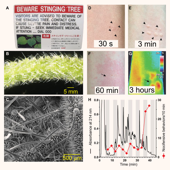 Stinging nettles of the genus Dendrocnide produce potent neurotoxins: (A) sign at a North Queensland National Park advising caution around stinging trees; (B) Dendrocnide excelsa petioles are covered in stinging hairs; (C) scanning electron micrograph of trichome structure on the leaf of Dendrocnide moroides; (D-G) cutaneous reaction resulting from an accidental sting with Dendrocnide moroides documented with an iPhone XR and NEC G120W2 thermal imager, illustrating almost immediate local piloerection (arrowheads in D), development of wheals where stinging hairs penetrate the skin (arrows in E), as well as a long-lasting axon reflex erythema (arrows in F and G) and associated local increase in skin temperature (degrees Celsius); (H) HPLC chromatogram of trichome extract from Dendrocnide excelsa; diamonds indicate nocifensive responses elicited by intraplantar administration of individual fractions in vivo in C57BL6/J mice, with a single late-eluting peak identified as the main pain-causing fraction. Image credit: Irina Vetter, Thomas Durek & Darren Brown, University of Queensland.