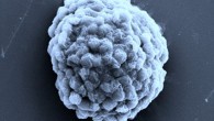 Electron microscopy image of a densely packed droplet of hydrogen-producing algal cells. Scale bar - 10 micrometers. Image credit: Xin Huang, Harbin Institute of Technology.