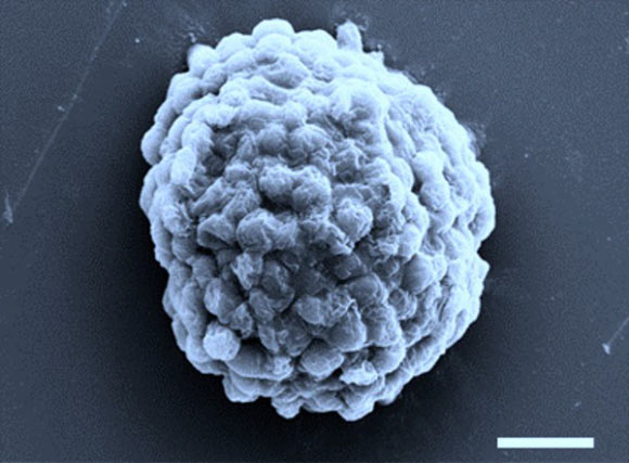 Electron microscopy image of a densely packed droplet of hydrogen-producing algal cells. Scale bar - 10 micrometers. Image credit: Xin Huang, Harbin Institute of Technology.